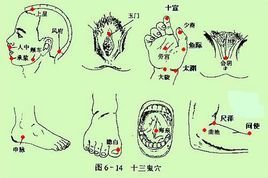 目录          十三鬼穴歌决 孙真人针版 徐秋夫版 注意事项 古代