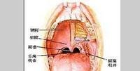是人体的一,是由腭帆后缘,左右及舌根*由,腭帆游离缘,两侧的腭舌弓