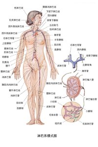 抬头有感觉,麻酸感,请问是淋巴癌吗